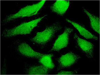 TF monoclonal antibody (M08), clone 1C2