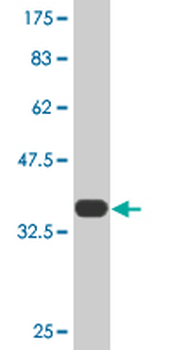 TF monoclonal antibody (M08), clone 1C2