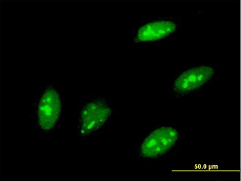 TEAD3 monoclonal antibody (M01), clone 1C4