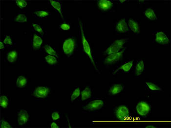 TCP1 monoclonal antibody (M01), clone 2B2-D6