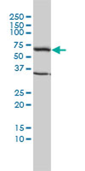 TCP1 monoclonal antibody (M01), clone 2B2-D6