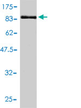 TCP1 monoclonal antibody (M01), clone 2B2-D6