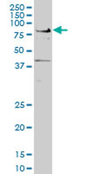 TCF7L2 monoclonal antibody (M04), clone 1A9