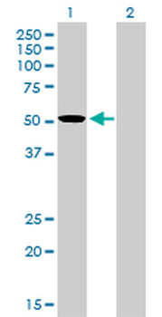 TCF7L2 monoclonal antibody (M02), clone 1B1