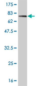TCF7L2 monoclonal antibody (M02), clone 1B1