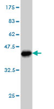 TCF3 monoclonal antibody (M01), clone 5G2