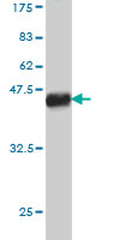 TBX5 monoclonal antibody (M01), clone 1G10