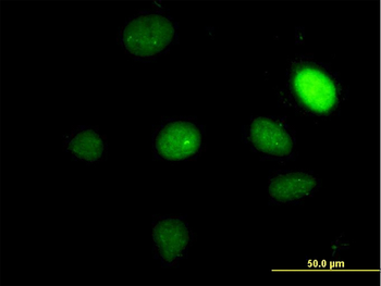 TBX2 monoclonal antibody (M01), clone 7G5