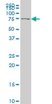 TBX2 monoclonal antibody (M01), clone 7G5