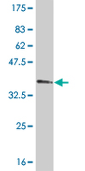 TBX2 monoclonal antibody (M01), clone 7G5