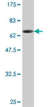 TBCC monoclonal antibody (M04), clone 3D3