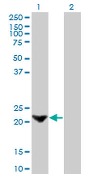 TAGLN monoclonal antibody (M01), clone 1E2