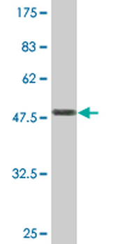 TAGLN monoclonal antibody (M01), clone 1E2