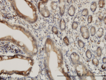 ADAM17 monoclonal antibody (M01), clone 1F6