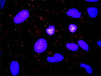 ADAM17 monoclonal antibody (M01), clone 1F6