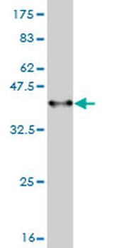 ADAM17 monoclonal antibody (M01), clone 1F6
