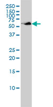 SUOX monoclonal antibody (M01), clone 1H1