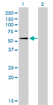 SUOX monoclonal antibody (M01), clone 1H1