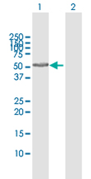SUOX MaxPab rabbit polyclonal antibody (D01)