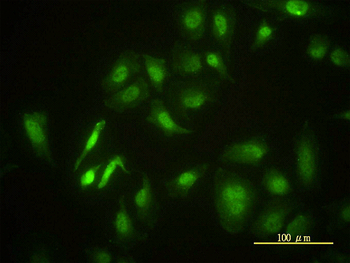 STK4 monoclonal antibody (M01), clone 1D7-8A10