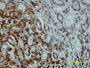 STK4 monoclonal antibody (M01), clone 1D7-8A10