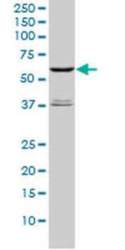 STK4 monoclonal antibody (M01), clone 1D7-8A10
