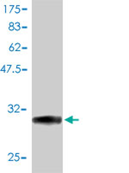 STK4 monoclonal antibody (M01), clone 1D7-8A10