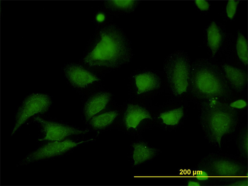 STIM1 monoclonal antibody (M01), clone 5A2
