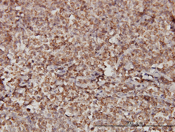 STIM1 monoclonal antibody (M01), clone 5A2