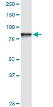 STIM1 monoclonal antibody (M01), clone 5A2