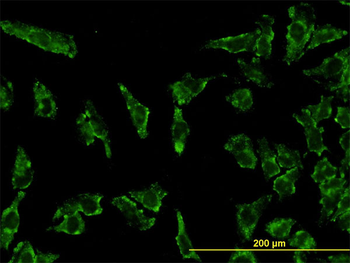 STAT3 monoclonal antibody (M02), clone 4D6