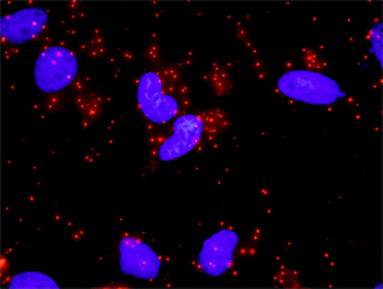 STAT3 monoclonal antibody (M02), clone 4D6