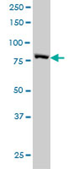 STAT3 monoclonal antibody (M02), clone 4D6