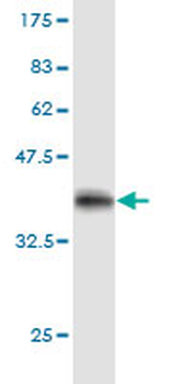 STAT3 monoclonal antibody (M02), clone 4D6