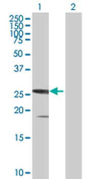 SSX5 purified MaxPab mouse polyclonal antibody (B01P)