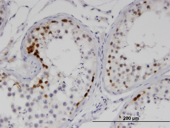 SSX2 monoclonal antibody (M01), clone 1A4