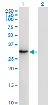 SSX2 monoclonal antibody (M01), clone 1A4
