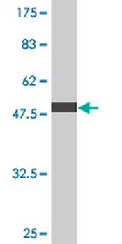 SSX2 monoclonal antibody (M01), clone 1A4