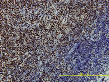SSB monoclonal antibody (M01), clone 1D6-H5