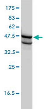 SSB monoclonal antibody (M01), clone 1D6-H5