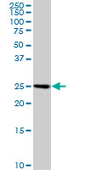 SPR polyclonal antibody (A01)