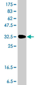 SPR polyclonal antibody (A01)