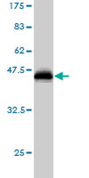 SPP1 monoclonal antibody (M01), clone 1E10