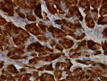 SPINK1 monoclonal antibody (M01), clone 4D4