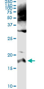 SPINK1 monoclonal antibody (M01), clone 4D4