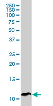 SPINK1 monoclonal antibody (M01), clone 4D4