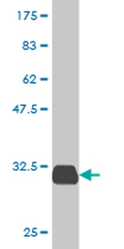 SPINK1 monoclonal antibody (M01), clone 4D4