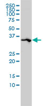 SPARC monoclonal antibody (M02), clone 1B2
