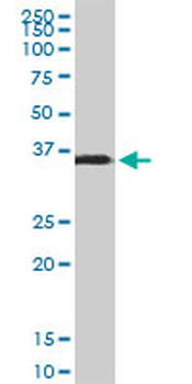 SPARC monoclonal antibody (M02), clone 1B2