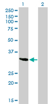 SPARC monoclonal antibody (M02), clone 1B2